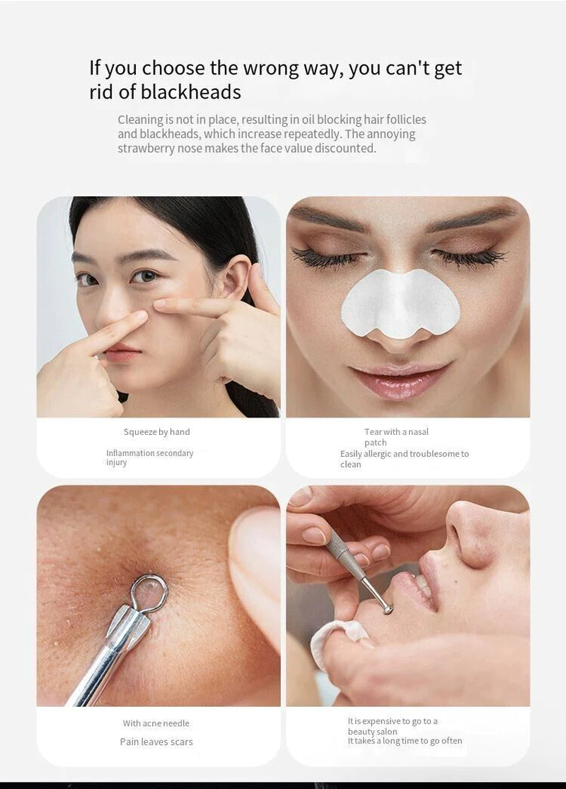 Deep Cleansing Facial Pore Blackhead & Whitehead Remover with Silicone Head - Facial Cleansing Devices Readi Gear