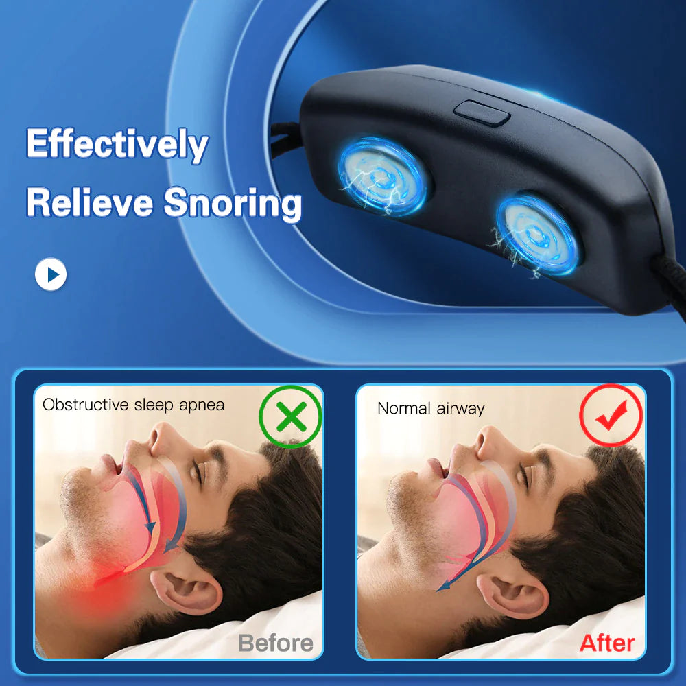 SnoreFree Pro - EMS Pulse Technology Anti Snoring Sleep Aid