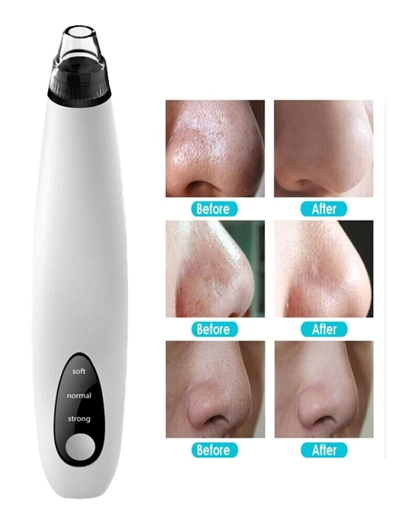 Deep Cleansing Facial Pore Blackhead & Whitehead Remover with Silicone Head